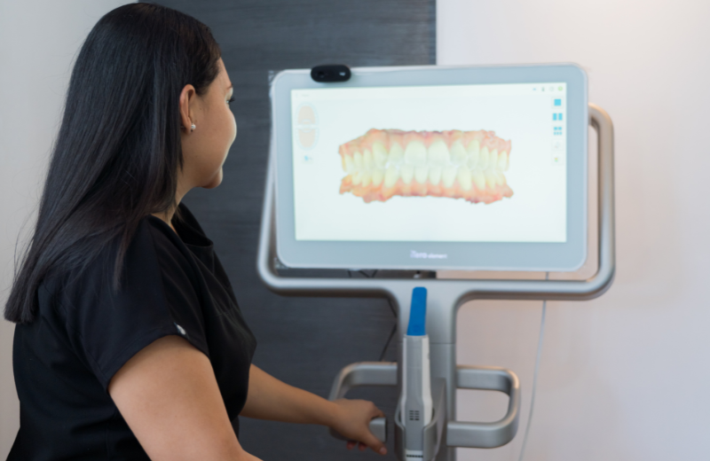 Escáner Intraoral